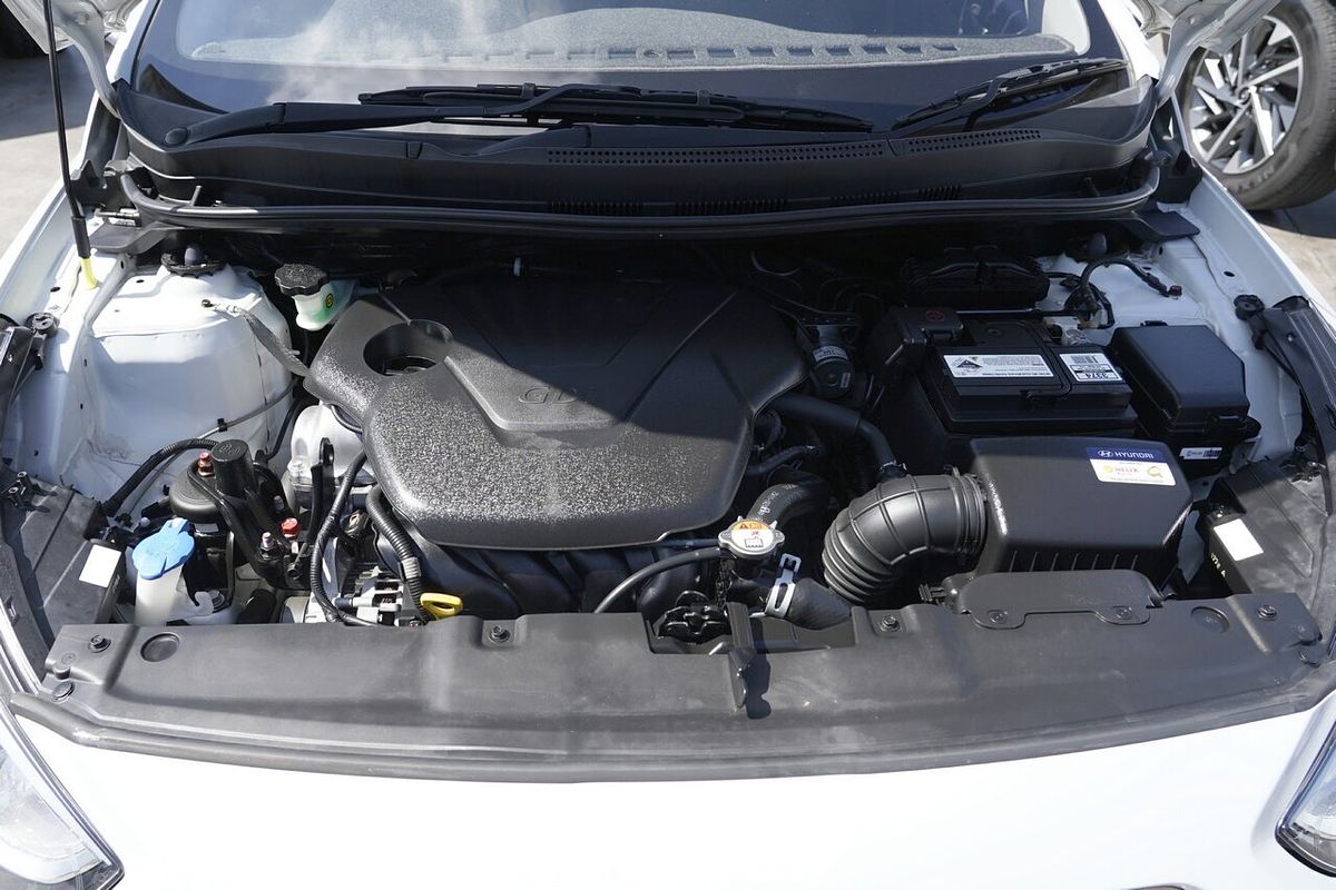 2017 Hyundai Accent Sport RB5