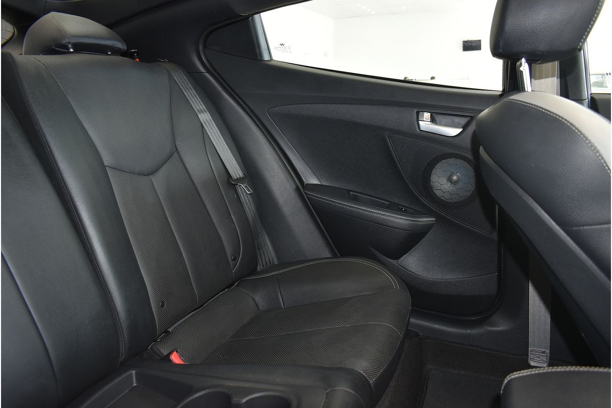 2016 Hyundai Veloster SR Turbo FS4 Series II