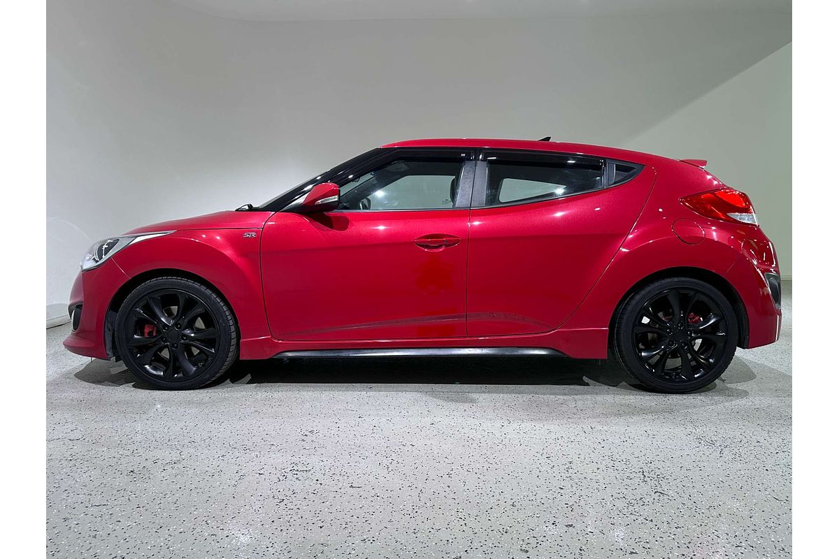 2016 Hyundai Veloster SR Turbo FS4 Series II
