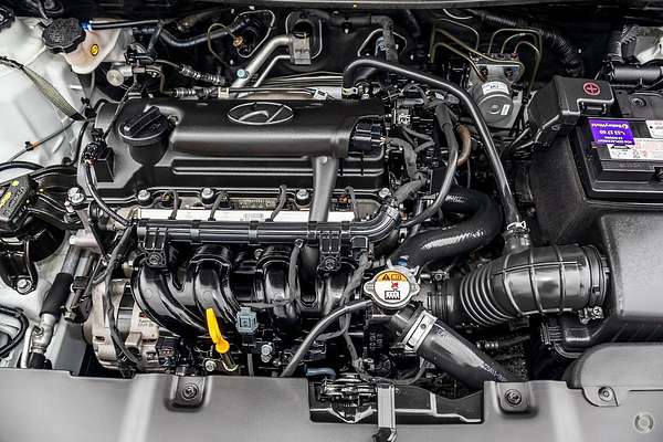 2017 Hyundai Accent Active RB4