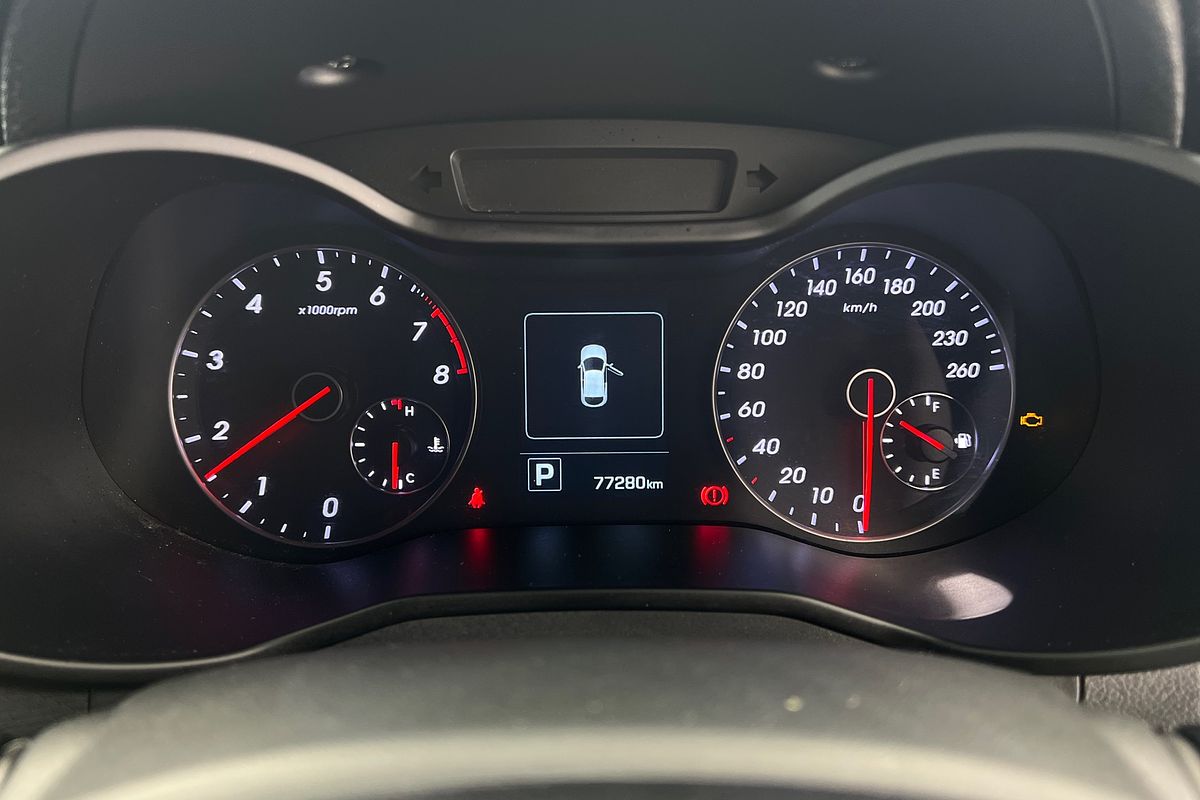 2016 Hyundai Veloster SR Turbo FS4 Series II