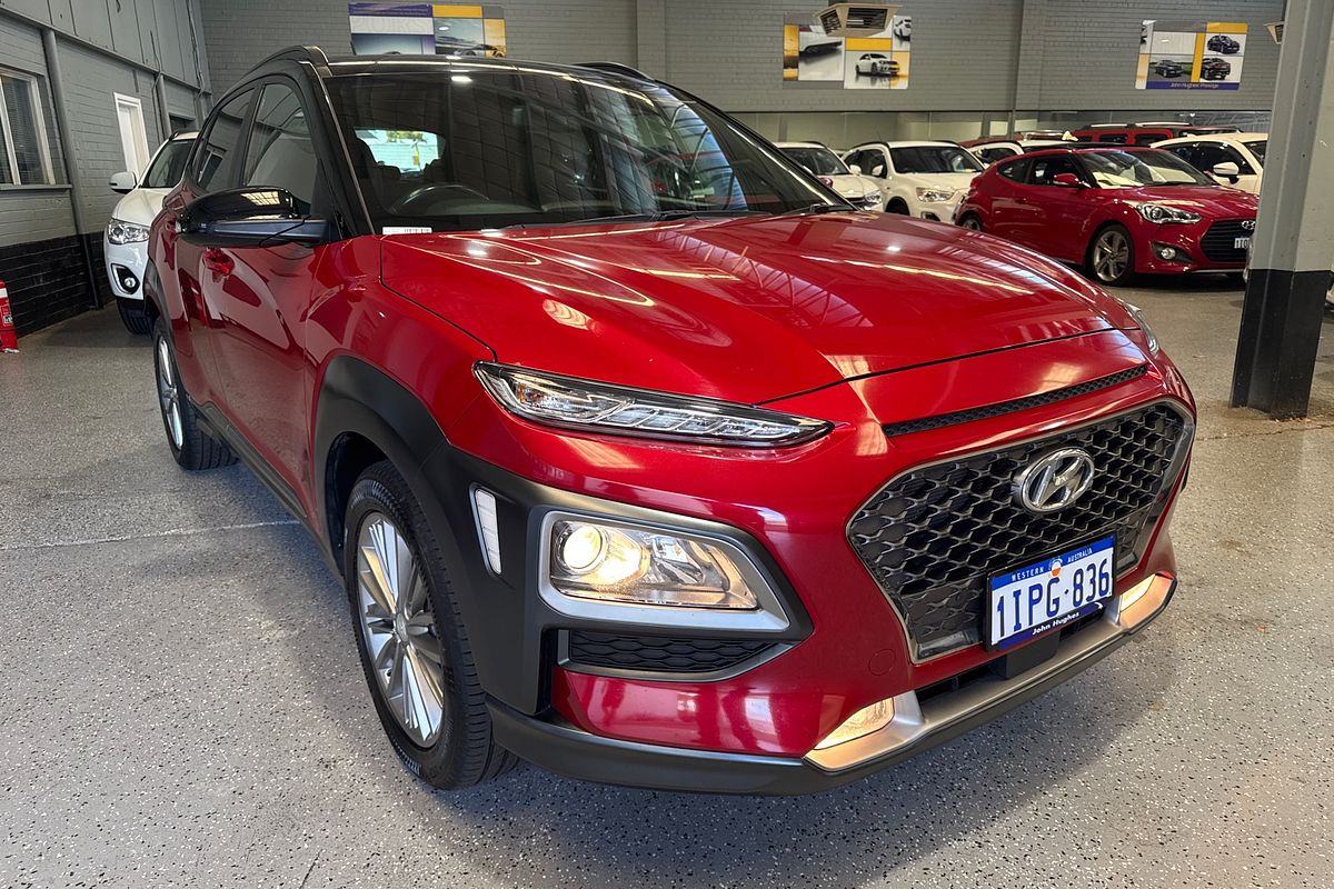 2017 Hyundai Kona Elite OS