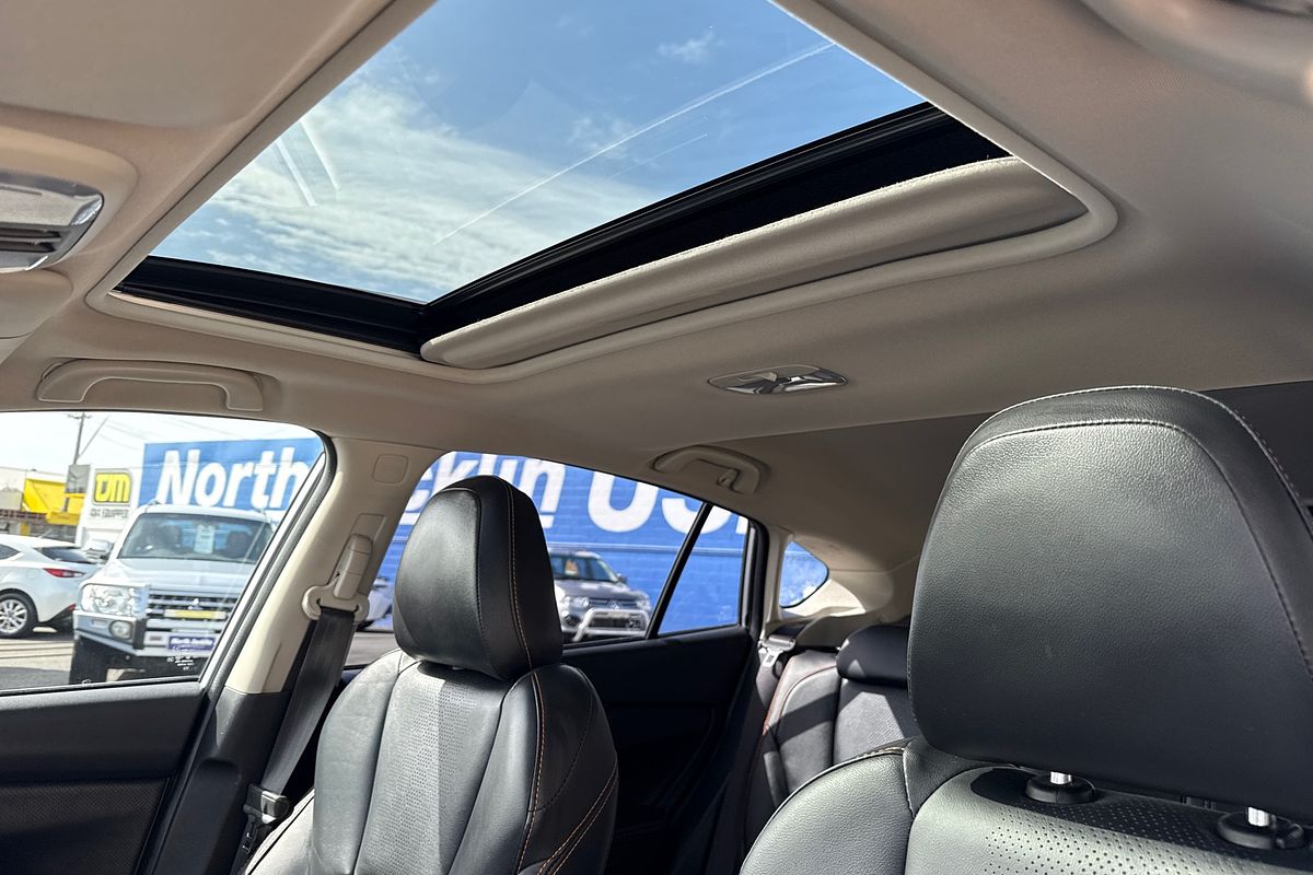 2017 Subaru XV 2.0i-S G5X