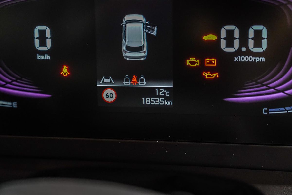 2024 Kia Sportage S NQ5