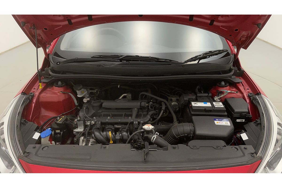 2015 Hyundai Accent Active RB3