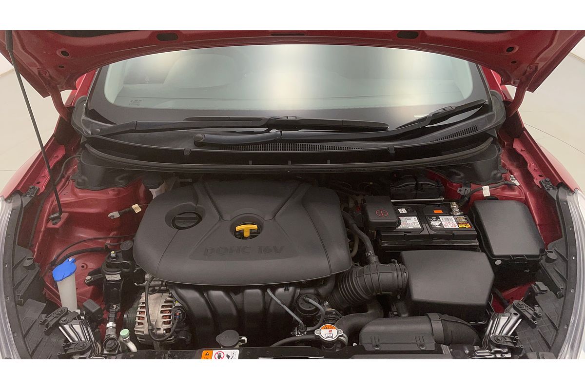 2017 Hyundai i30 ACTIVE GD4 SERIES 2 UPDATE