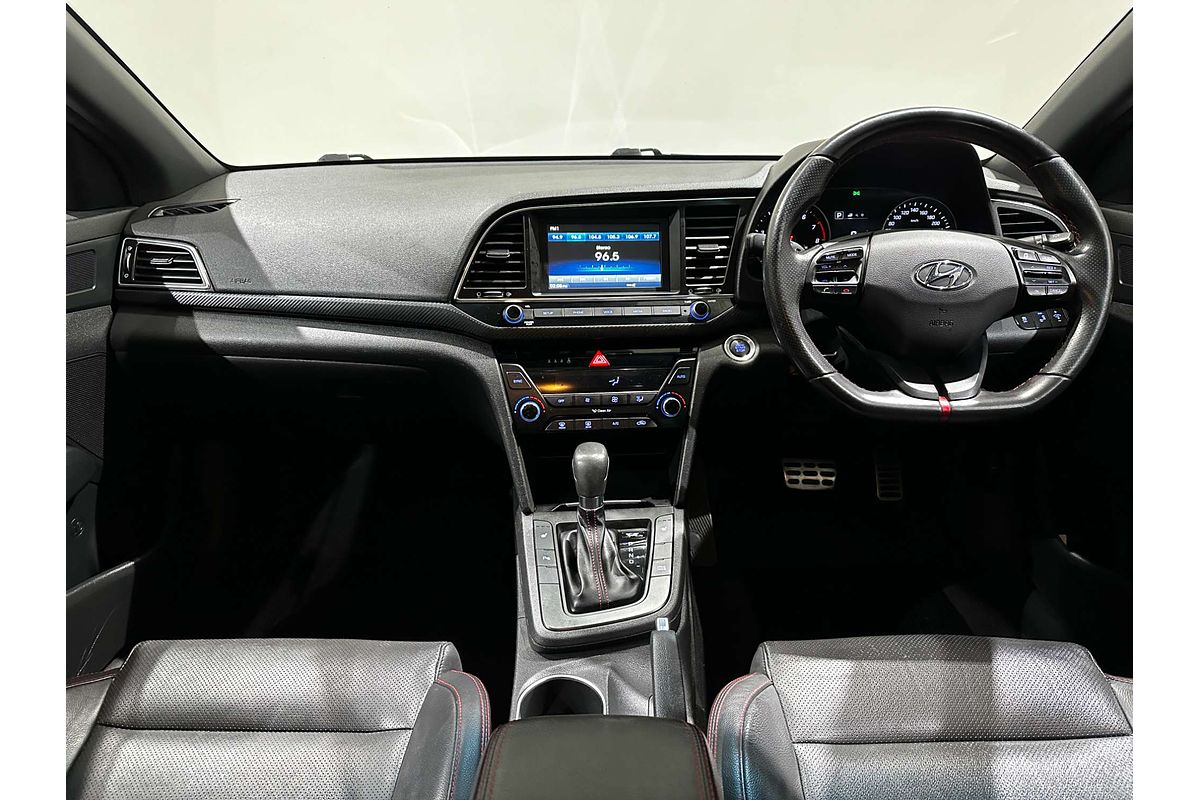 2017 Hyundai Elantra SR Turbo AD