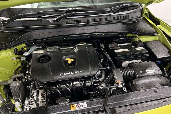 2018 Hyundai Kona Highlander OS.2