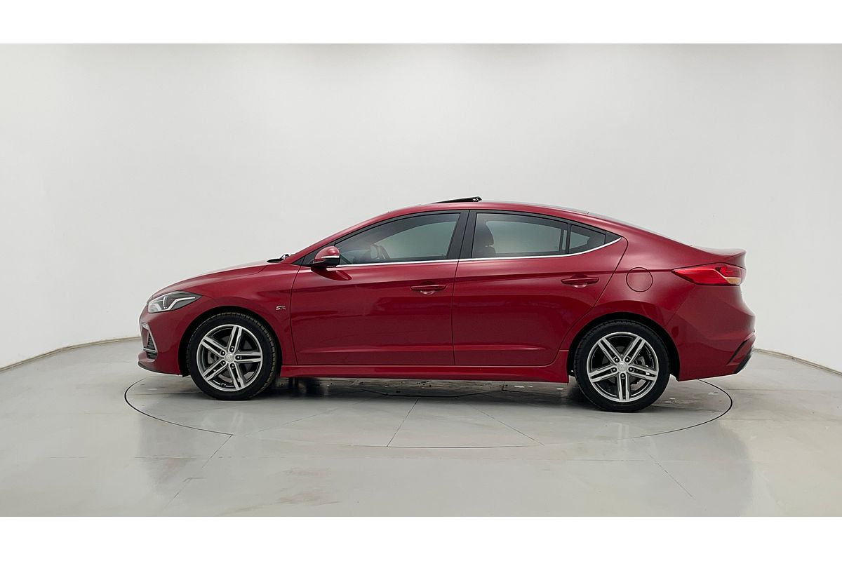 2017 Hyundai ELANTRA SR TURBO AD