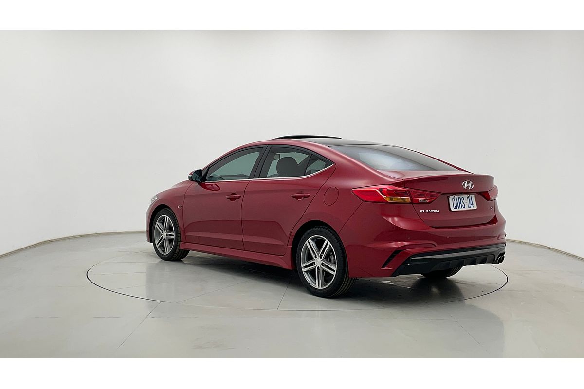 2017 Hyundai ELANTRA SR TURBO AD