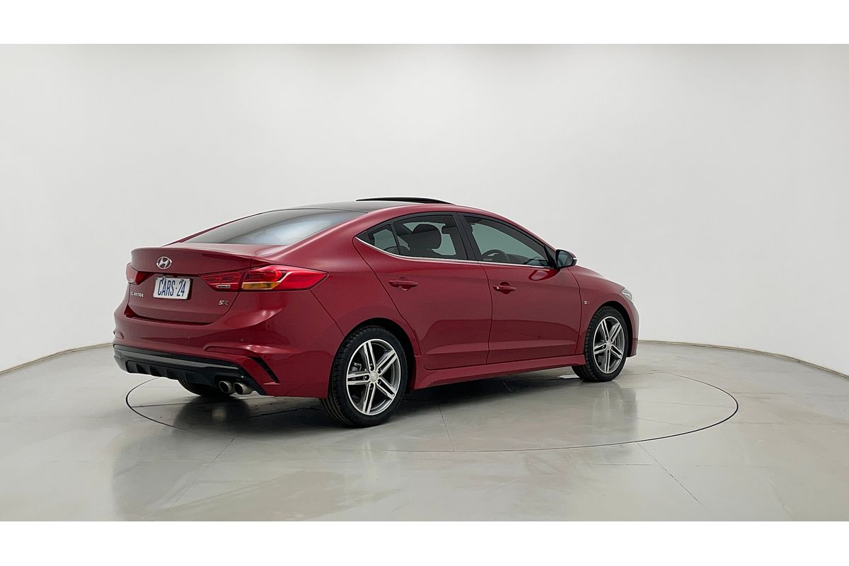 2017 Hyundai ELANTRA SR TURBO AD