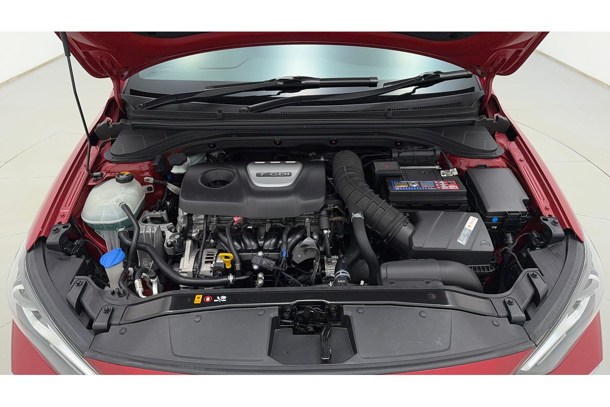 2017 Hyundai ELANTRA SR TURBO AD