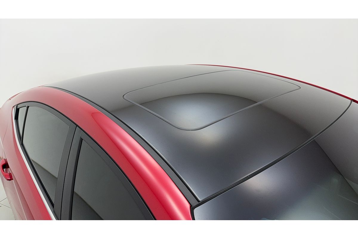 2017 Hyundai ELANTRA SR TURBO AD
