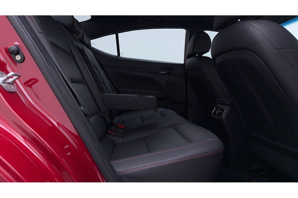 2017 Hyundai ELANTRA SR TURBO AD