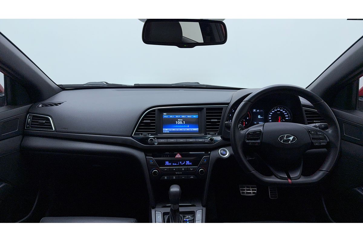 2017 Hyundai ELANTRA SR TURBO AD