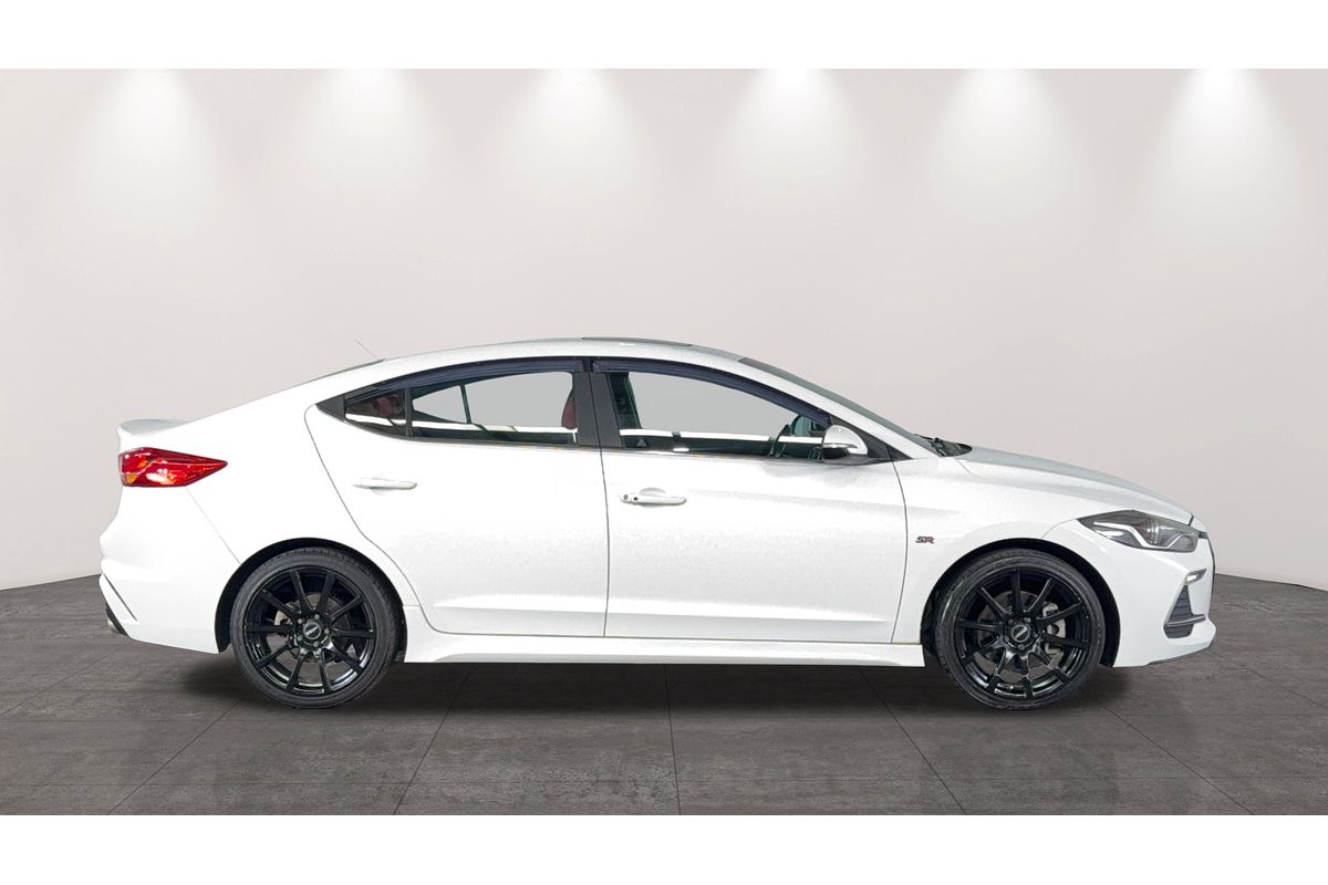 2017 Hyundai Elantra SR Turbo AD