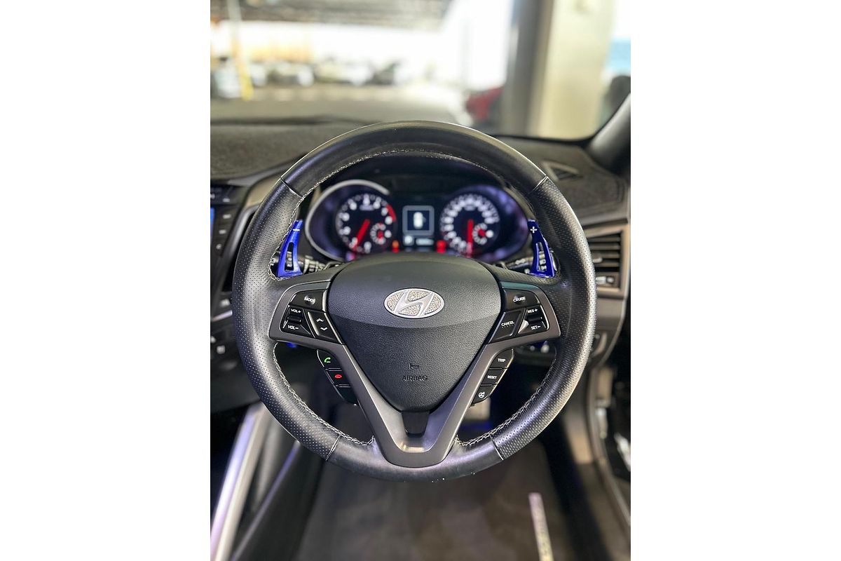 2015 Hyundai Veloster SR Turbo + FS4 Series II
