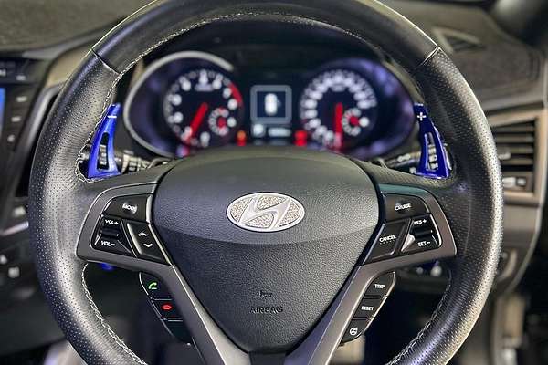 2015 Hyundai Veloster SR Turbo + FS4 Series II