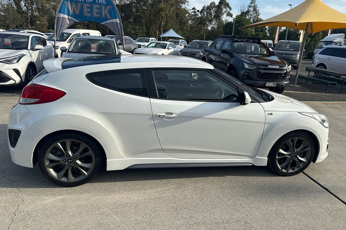 2016 Hyundai Veloster SR Turbo FS4 Series II
