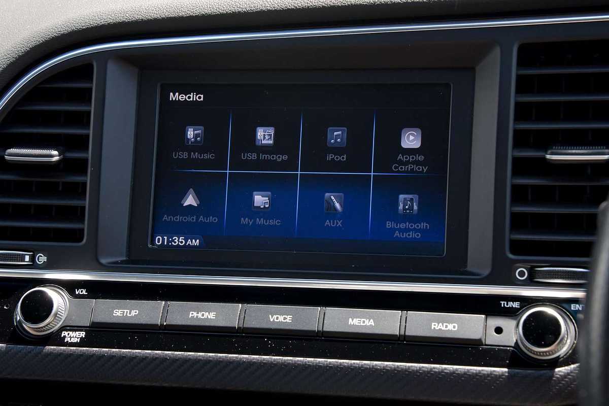 2017 Hyundai Elantra SR Turbo AD