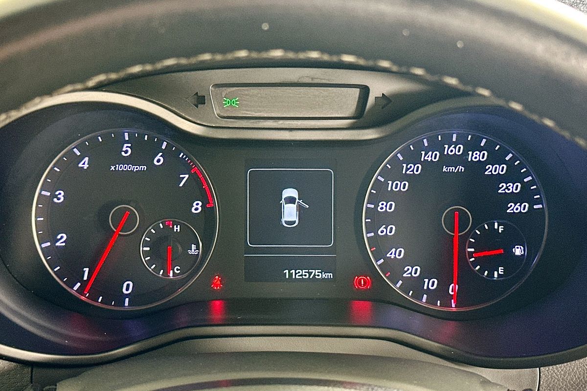 2015 Hyundai VELOSTER SR TURBO FS3